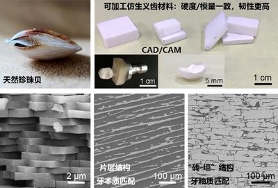 金属所研发出全新人牙匹配型仿生义齿材料